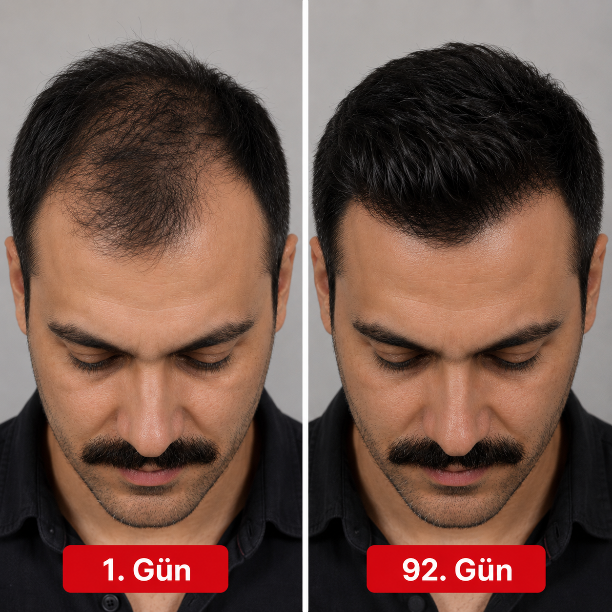Kırmızı Işık Terapi Şapkası