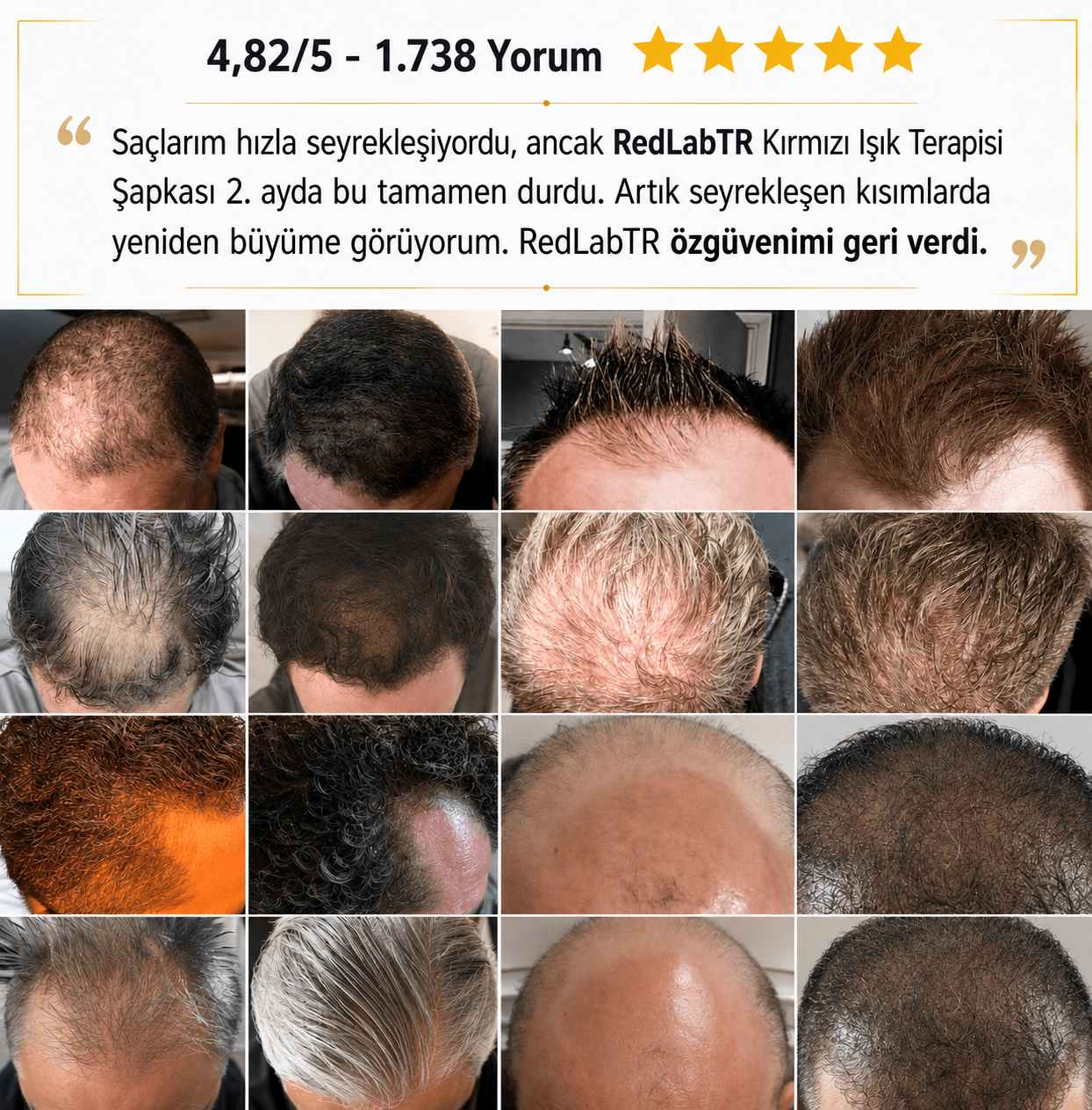 Kırmızı Işık Terapi Şapkası