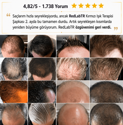 Kırmızı Işık Terapi Şapkası